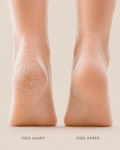 Silkpod — Pieds lisses en 5 minutes